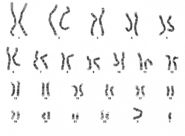 chromosomes