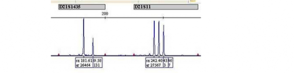 a smaller graph of lab results