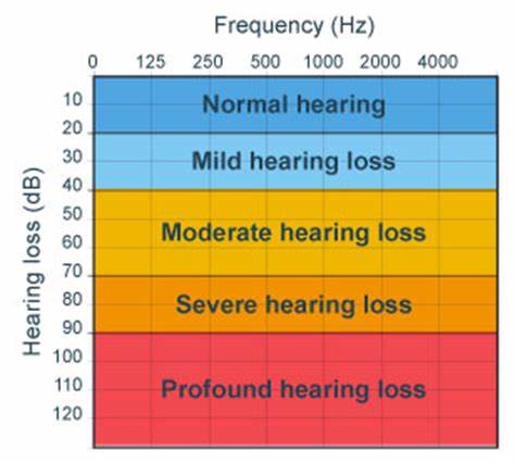 A chart of hearing loss severity. 
0 to 20 dB = Normal hearing
20 to 40 dB = Mild hearing loss
40 to 70 dB = Moderate hearing loss
70 to 90 dB = Severe hearing loss
90 to 130 dB = Profound hearing loss