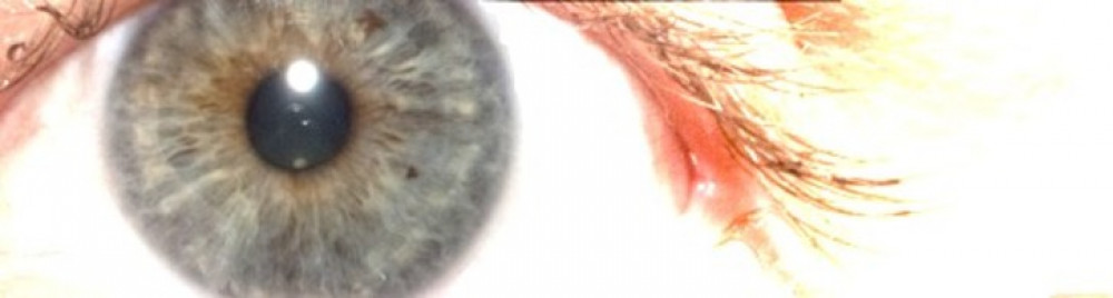 Image of an eye