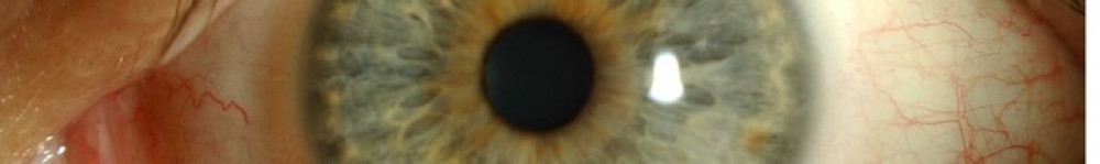 Close up of eyeball