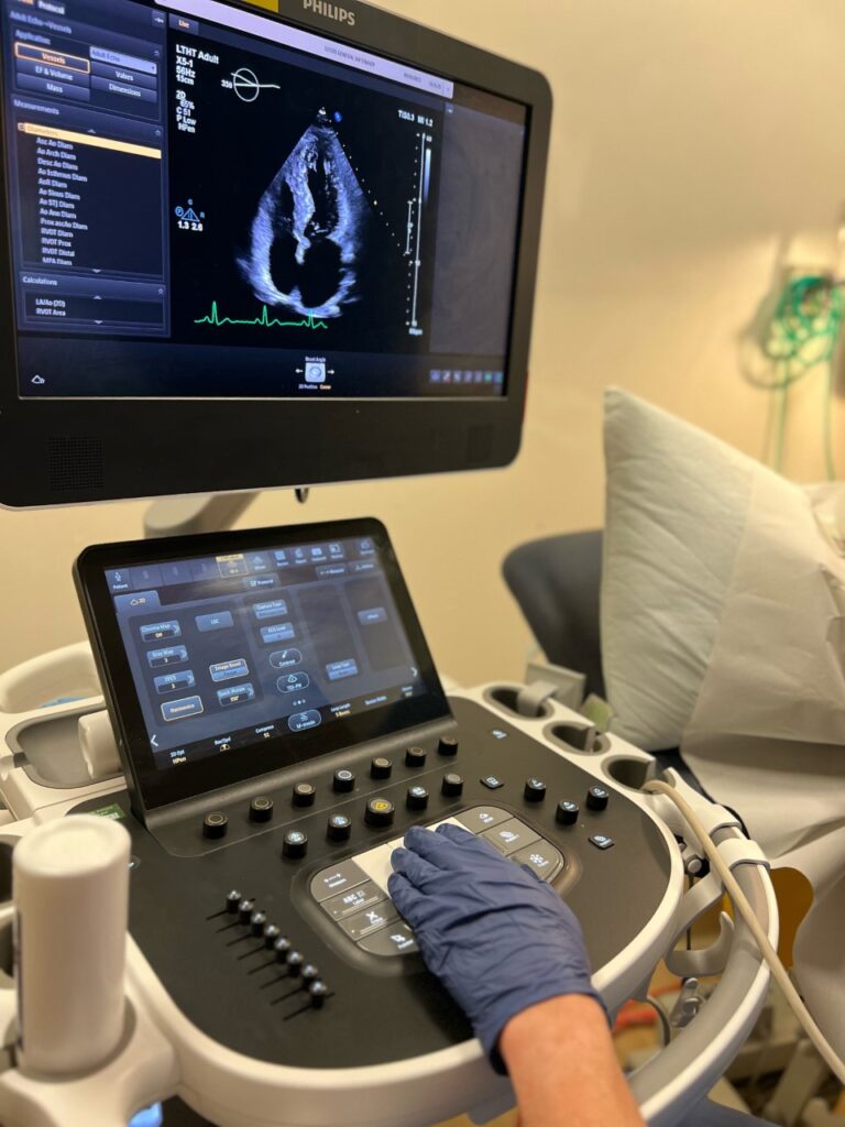 ultrasound scan machine