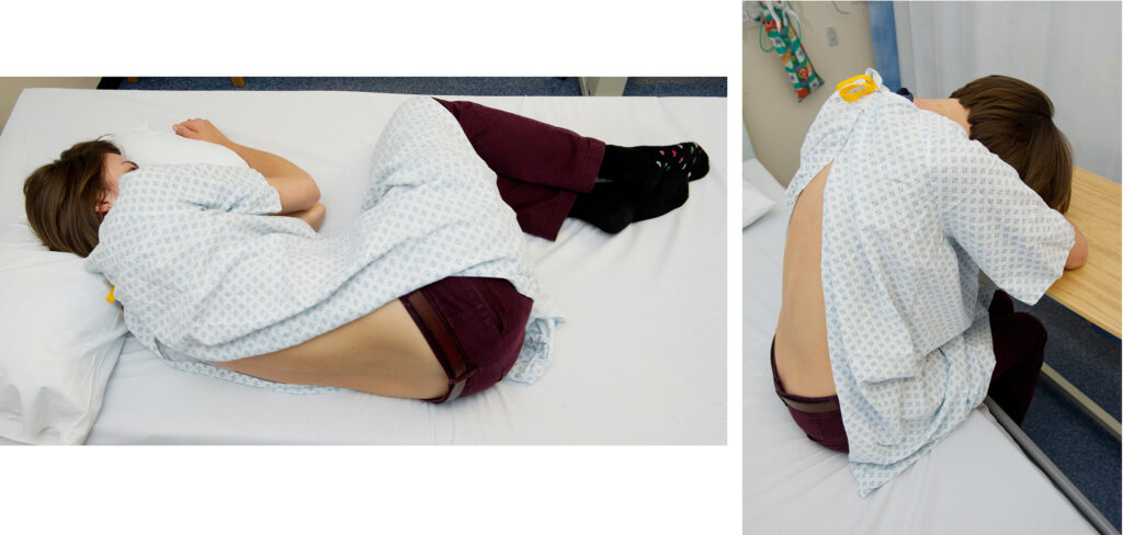 Photos showing the position you may need to be in to have the lumbar drain inserted