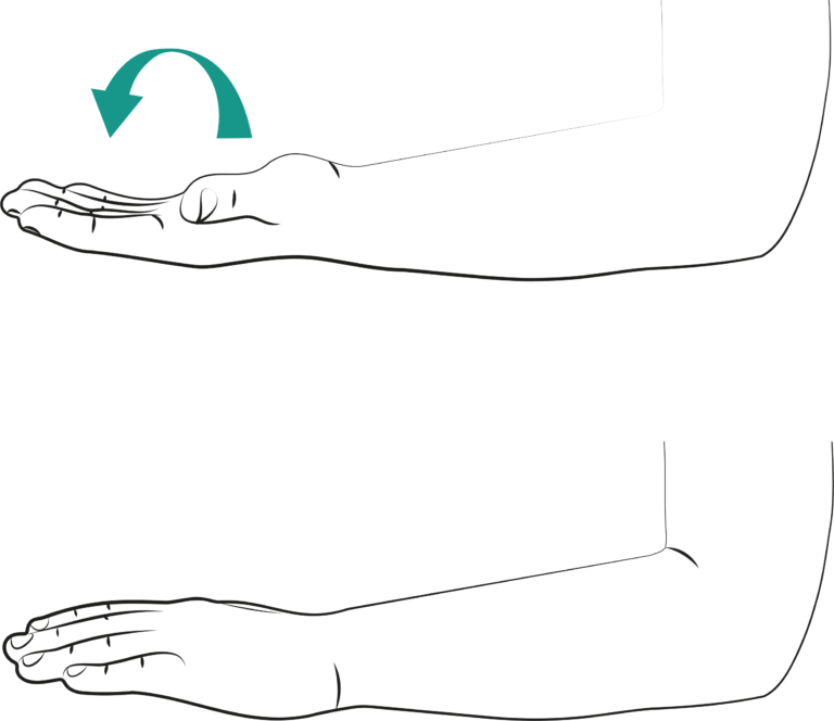 Collar Bone Injuries - Leeds Teaching Hospitals NHS Trust