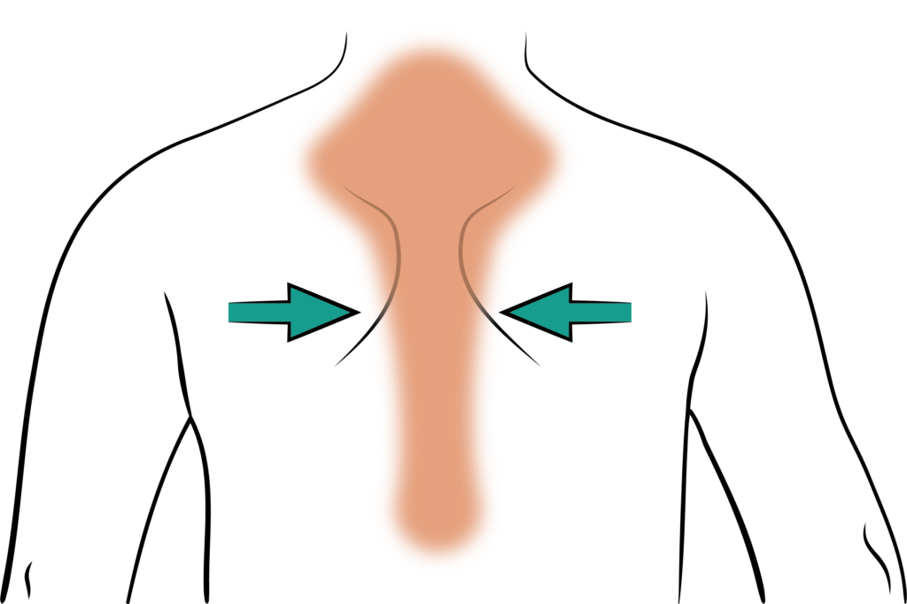 An illustration showing the scapula squeezes exercise.