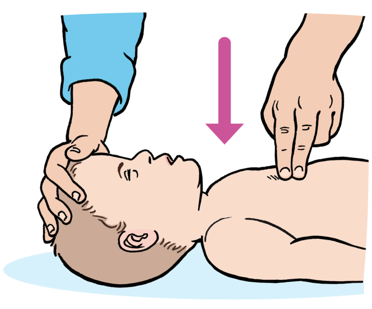 Bls Compression Position Baby Basic Life Support - Leeds Teaching Hospitals NHS Trust