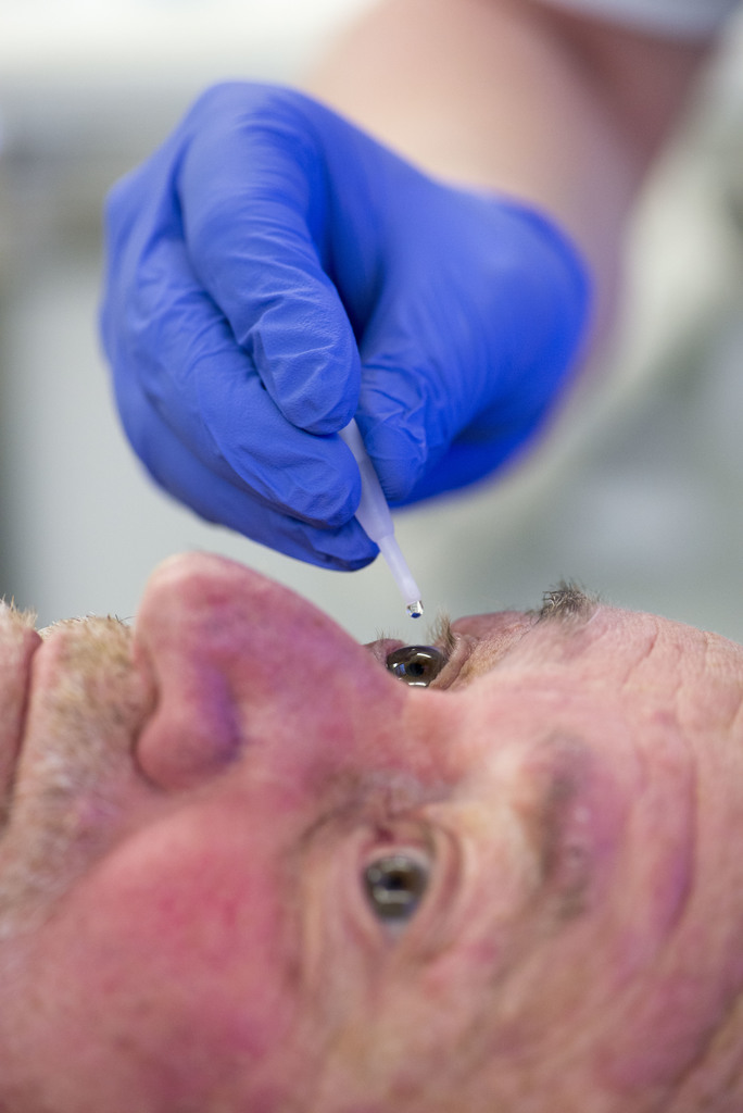 Photograph showing a clinician applying local anaesthetic eye drops into an eye.