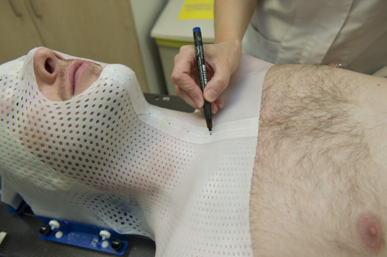 Stereotactic Ablative Radiotherapy (SABR) to the spine - Leeds Teaching ...