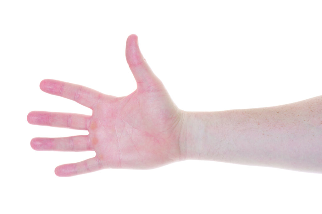 Photograph of a persons hand with fingers out stretched