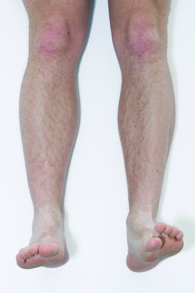 Photograph of a persons legs with feet relaxed
