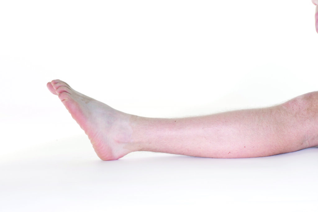 Photograph of a persons leg with foot outstretched forward