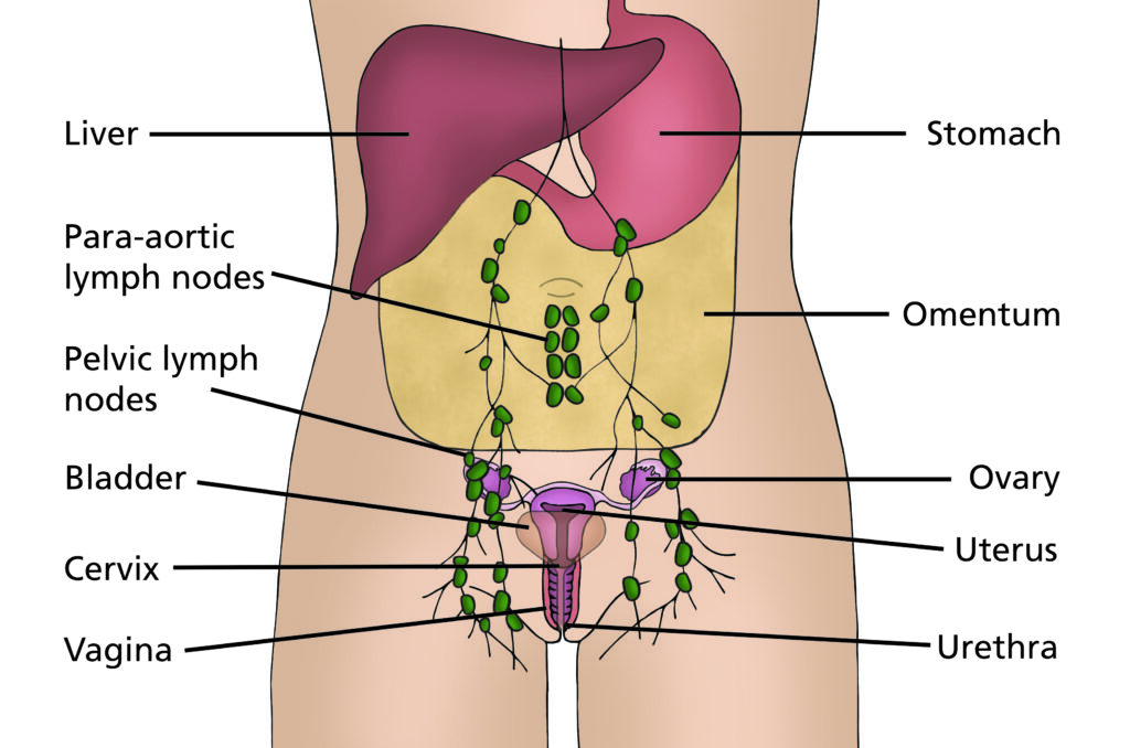 Illustration showing where organs are in the body with labels for liver, stomach, omentum, para-aortic lymph nodes, pelvic lymph nodes, ovary, bladder, uterus, cervix, vagina and urethra.