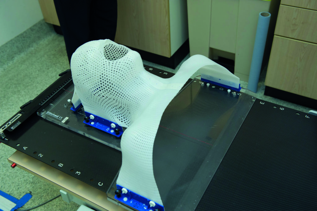 Photograph of a radiotherapy mask fastened to couch.