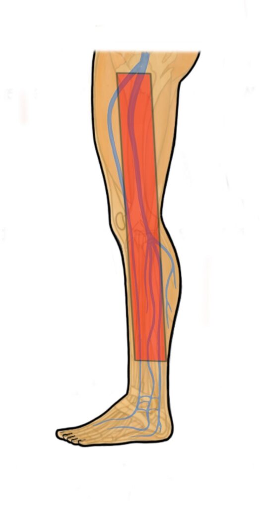 Illustration of a leg showing the main veins