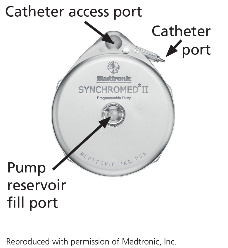 Figure 1. A photograph of a pump with arrows to the 'catheter access port', the 'catheter port' and the 'pump reservoir fill port'. This image was reproduced with permission of Medtronic, Inc.