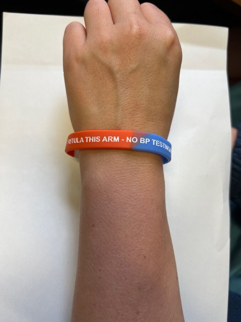 Photograph of a person wearing a fistula alert band.