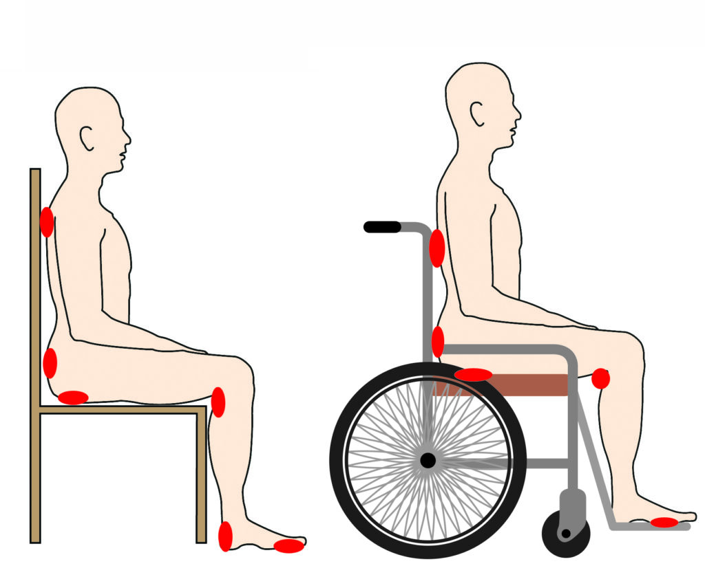 Image showing areas highlighted in red where pressure ulcers may develop and the risk areas when sat in a chair/wheelchair or laid down.
