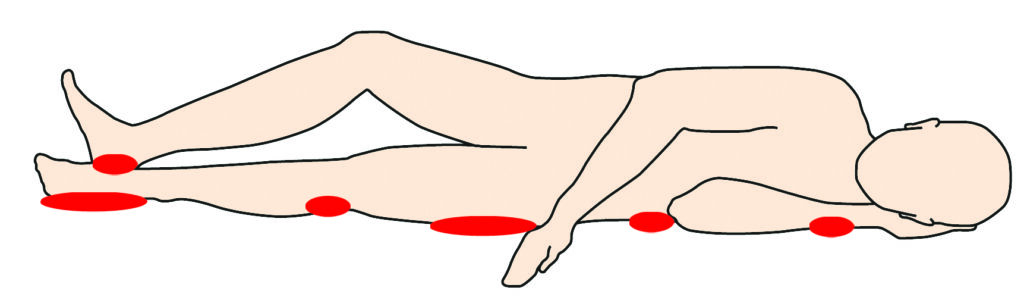 Illustration showing the pressure areas that will need checking when you are lying on your side.