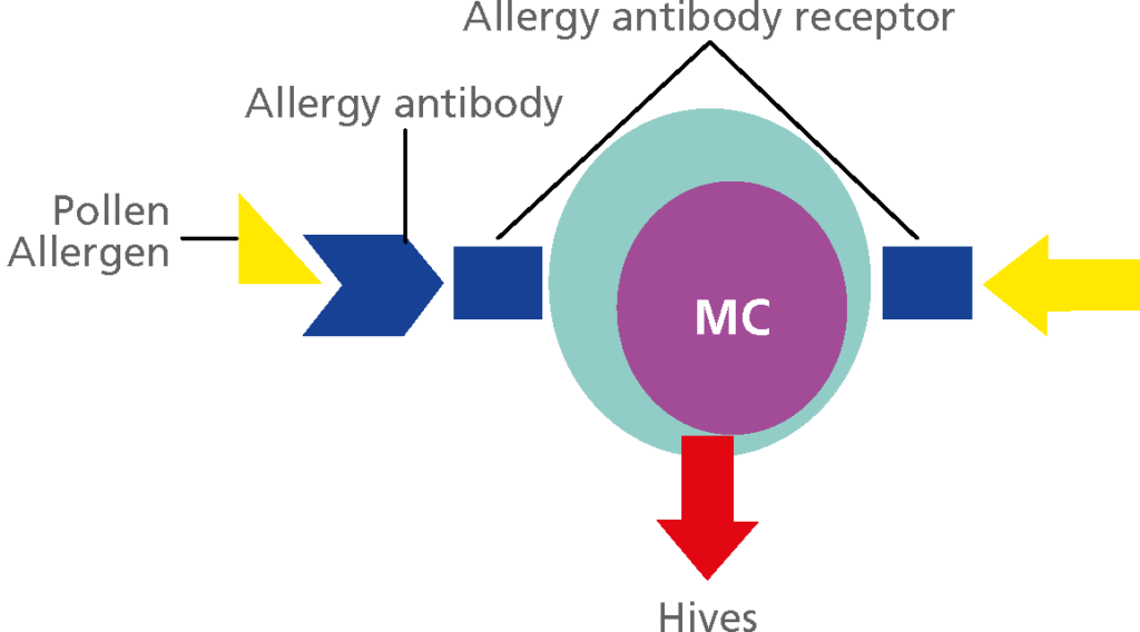 Allergy antibody receptor, Allergy antibody, Pollen allergen, MC, Hives.