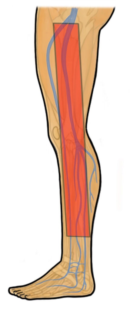 A leg diagram highlights a deep vein where a blood clot can form.
