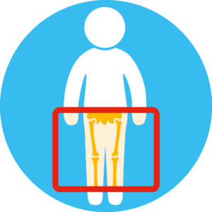 Leg x-ray illustration