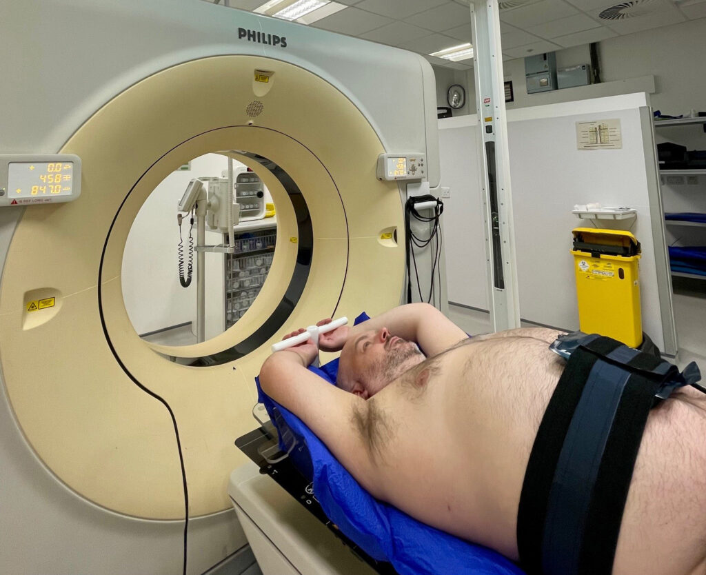 Photograph of a patient with arms above their head, in customised support and with compression belt.