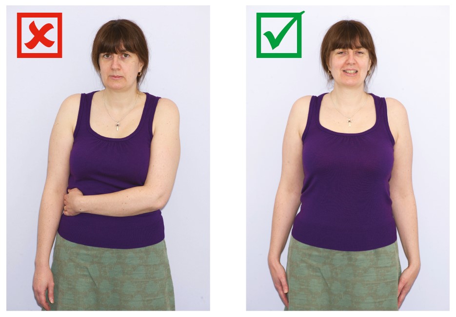 Photograph of a patient with arms in different positions.