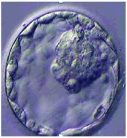 Photograph of a 5 day old embryo (Blastocyst).