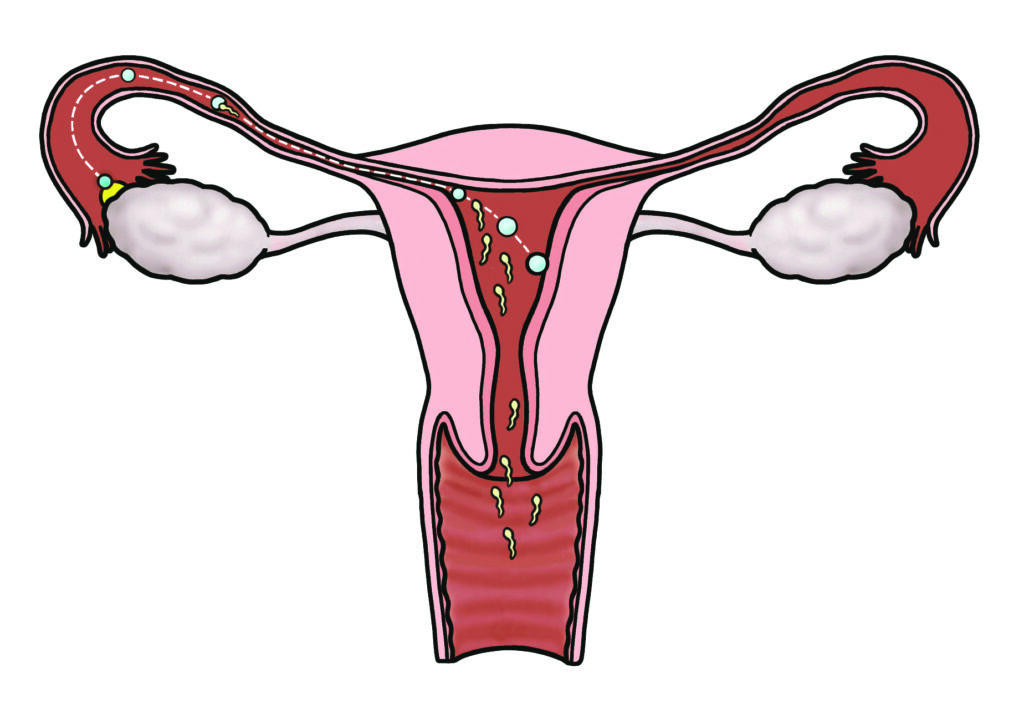 An illustration showing the journey made by sperm and egg through the female reproductive system.