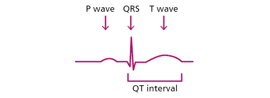 Graph showing P wave, QRS, T wave and a QT interval