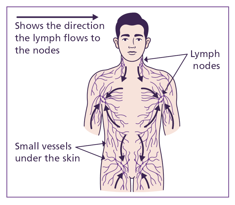 Illustration of drainage through the healthy lymphatic system. It shows the various lymph nodes and vessels in an adult body with arrows showing the direction the lymph flows.