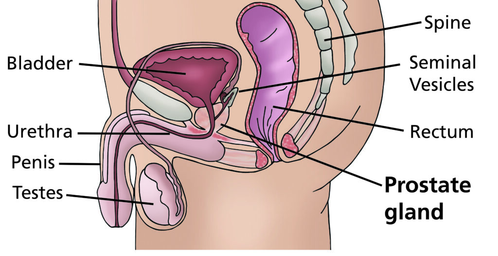 Illustration showing the anatomy of the prostate and pelvic organs in a male patient.