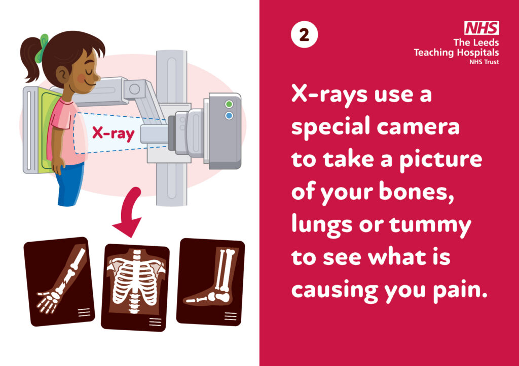 Illustration of a young person stood up having an X-Ray of their chest, below this are 3 X-ray images of the body - an arm, the ribcage, and a lower leg/foot.