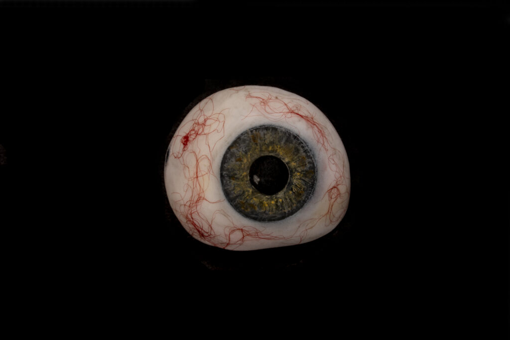 Artificial eye - A custom-made prosthetic eye designed to restore appearance after the removal of an eye or to fit over a non-functioning eye.