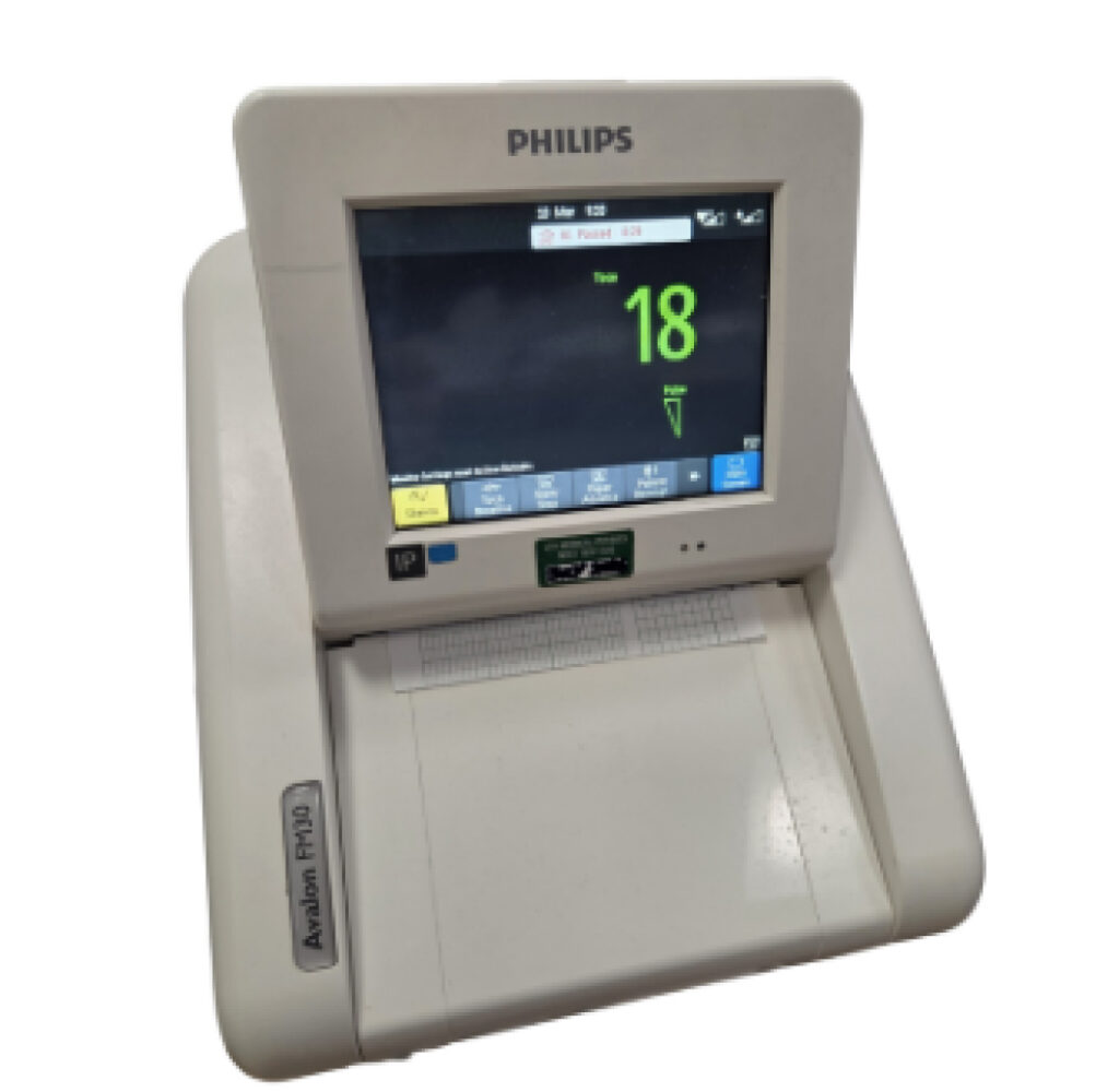 Photograph of a CTG monitor.