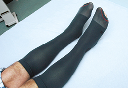 Photograph of a person wearing elastic stockings.
