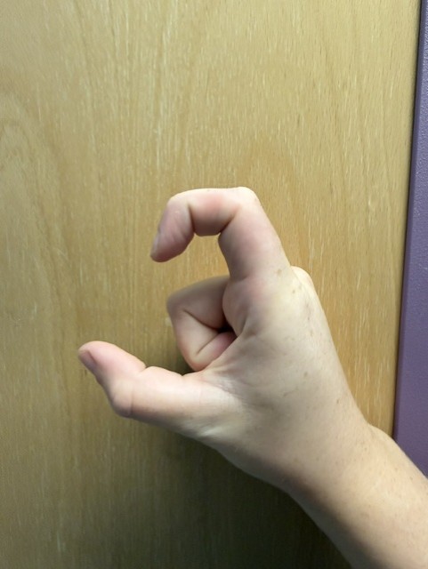 Image shows someone bending their index finger trying to get the tip of the finger as close to the palm as possible