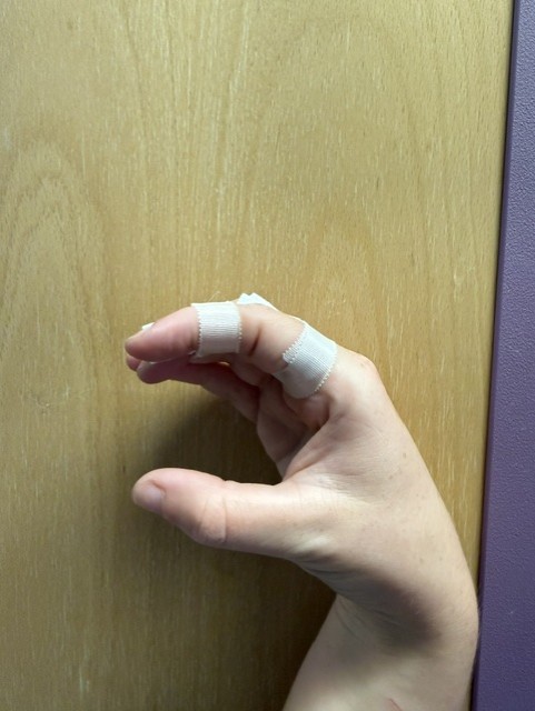 Image shows the index and middle fingers neighbour strapped, with the fingers bent round making a C shape with the thumb