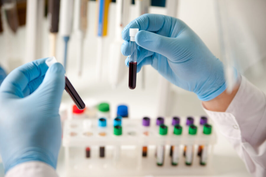 Laboratory scientist looking at test tubes with blood and analysis